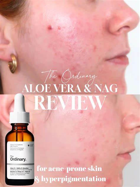 The Ordinary  Aloe 2% + NAG 2% Solution 30ml